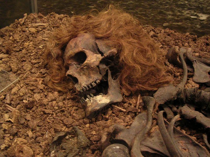 Mental Disorders Bog Mummy