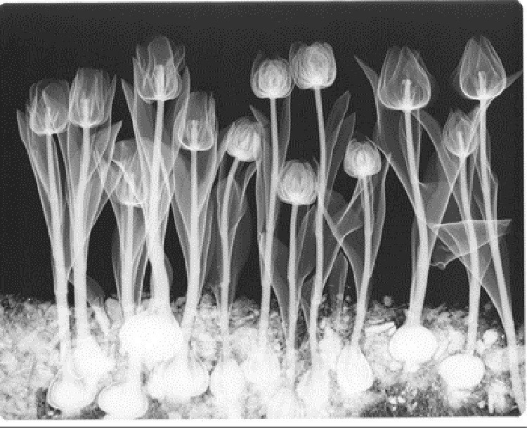 X-ray Art Negative