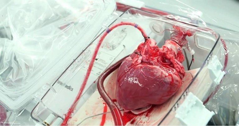 transplant memories