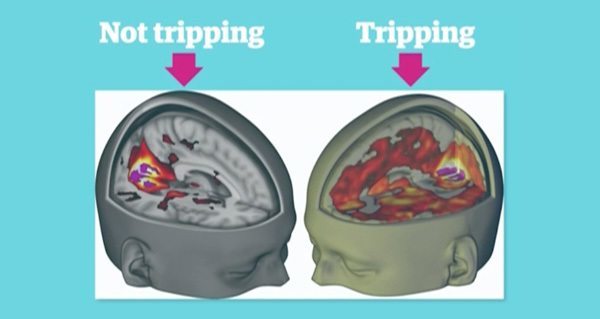 Lsd Brain Scans