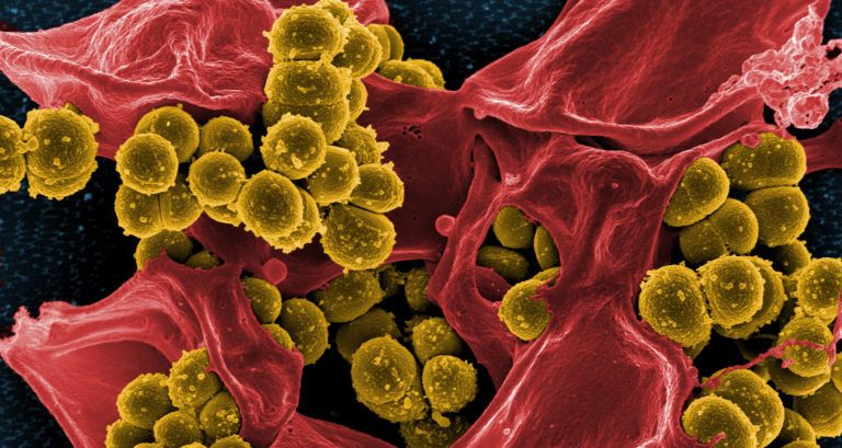 Mrsa Featured