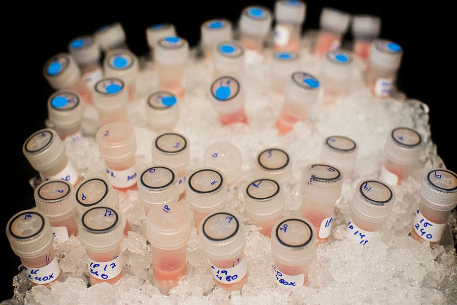 Cancer Test