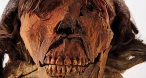 Mummy Teeth