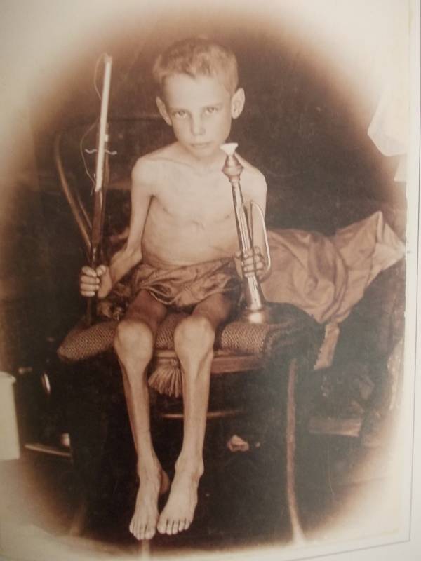 Starving Boy At Irene Camp