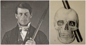 Phineas Gage