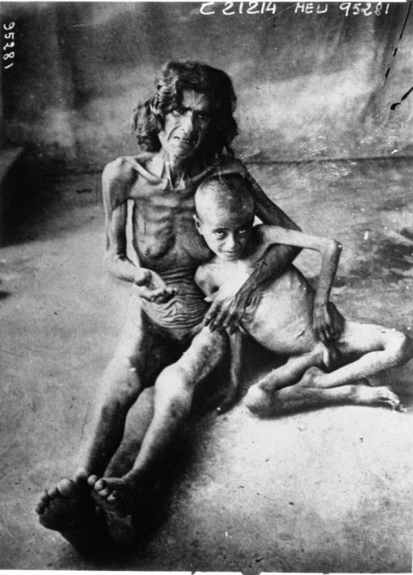 Starving Mother And Child