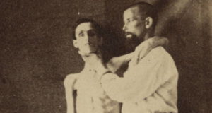 Starved Andersonville Prisoner