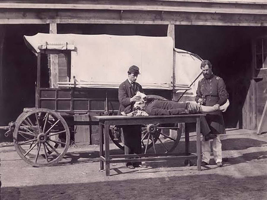 Civil War Amputation