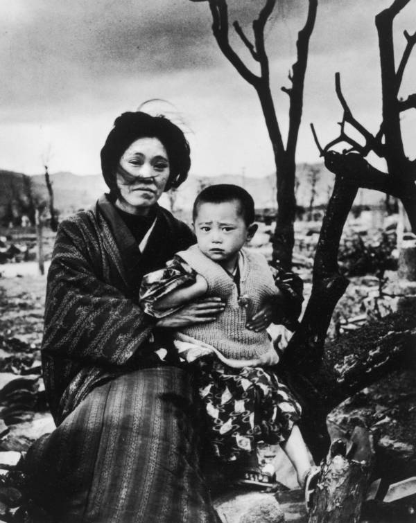Hiroshima Aftermath Mother And Child