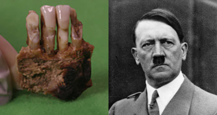 Hitler Teeth Gross