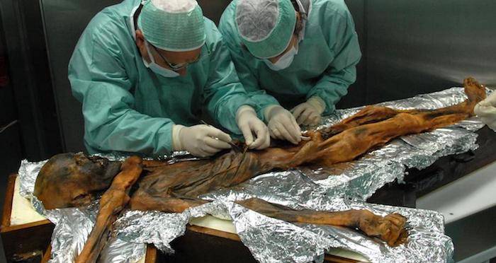 Otzi Iceman