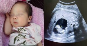 Baby Born Pregnant