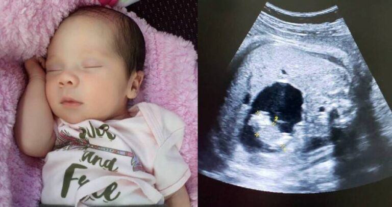 Baby Born Pregnant