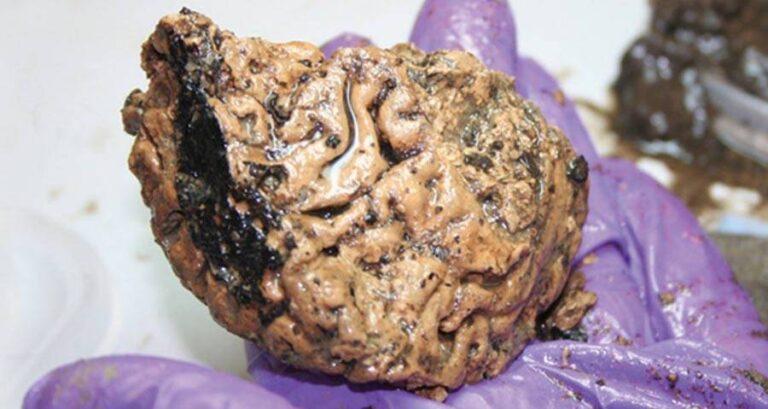 Decapitated Skull Brain Specimen