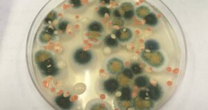 Black Fungi In Lab