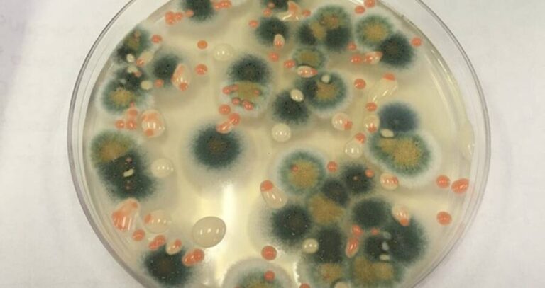 Black Fungi In Lab