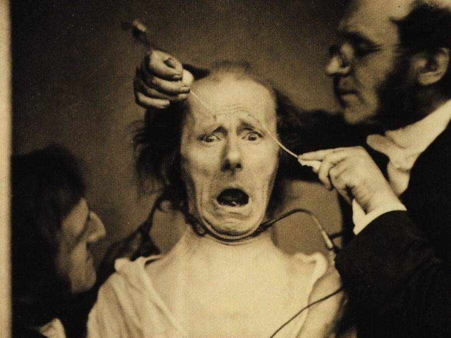 Scariest Picture Ever Taken Duchenne De Boulogne