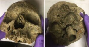 Greta Skull Front And Bottom