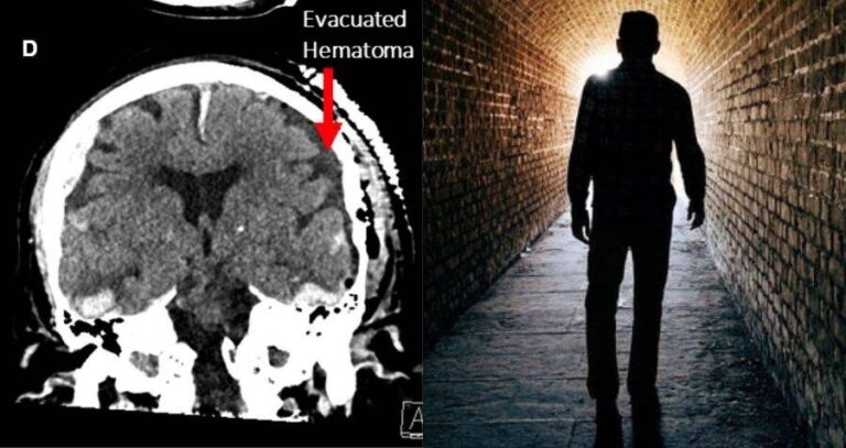 Brain Scan And Man