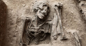 Hospital Real De San Andres Skeletons