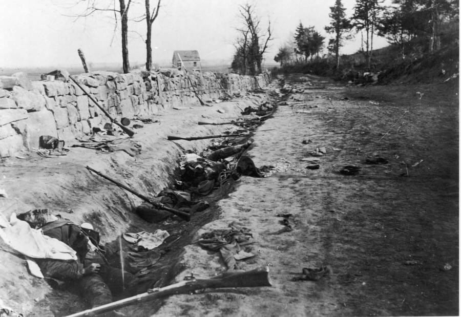 Mathew Brady Photos Of Civil War Casualties