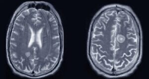 Brain Scan