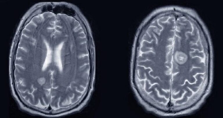 Brain Scan