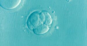 Human Embryo