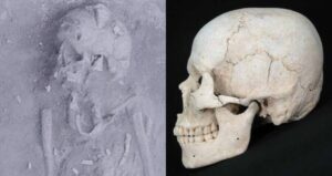 Deformed Skull
