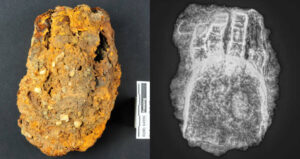 Renaissance Hand And X Ray