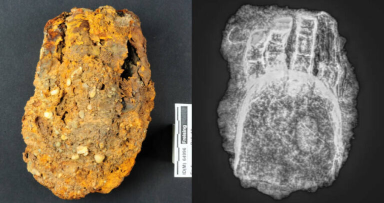 Renaissance Hand And X Ray