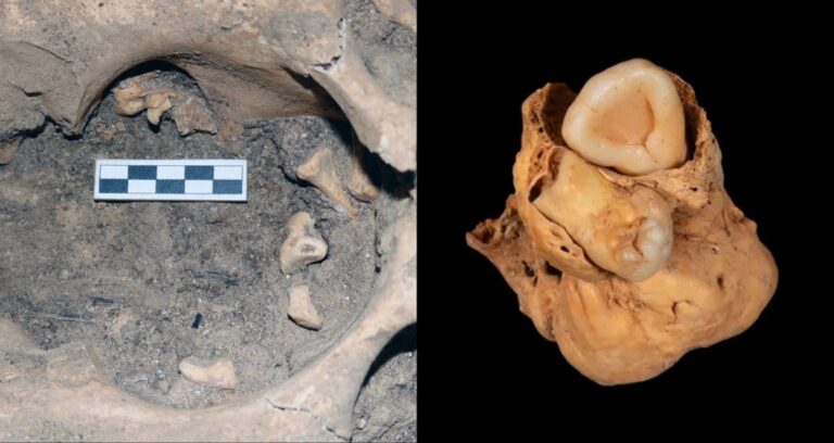 Tumor With Teeth Featured